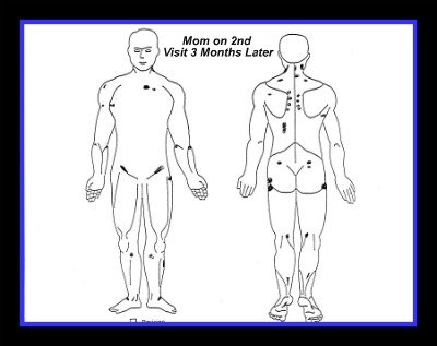 guaifenesin protocol body map